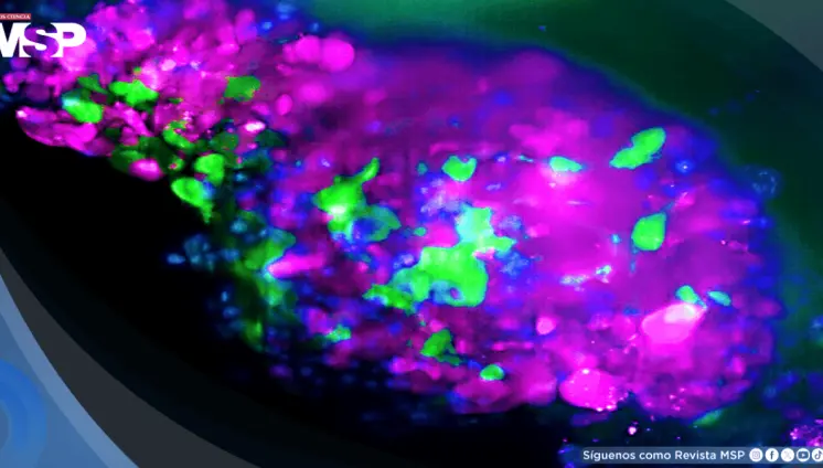 Así se detecta el cáncer en estadio 0: Ofrece supervivencia del 99 % si se diagnostica a tiempo