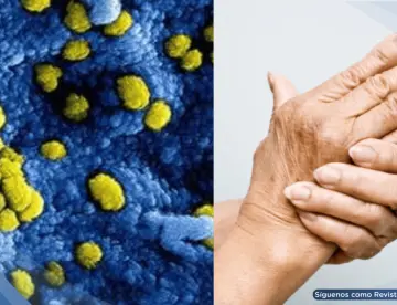 Descubren cómo el equilibrio de la microbiota podría alterar el tratamiento de enfermedades reumáticas