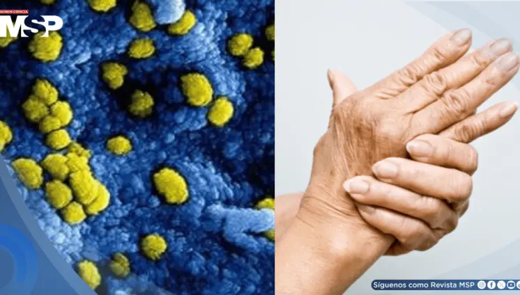 Descubren cómo el equilibrio de la microbiota podría alterar el tratamiento de enfermedades reumáticas