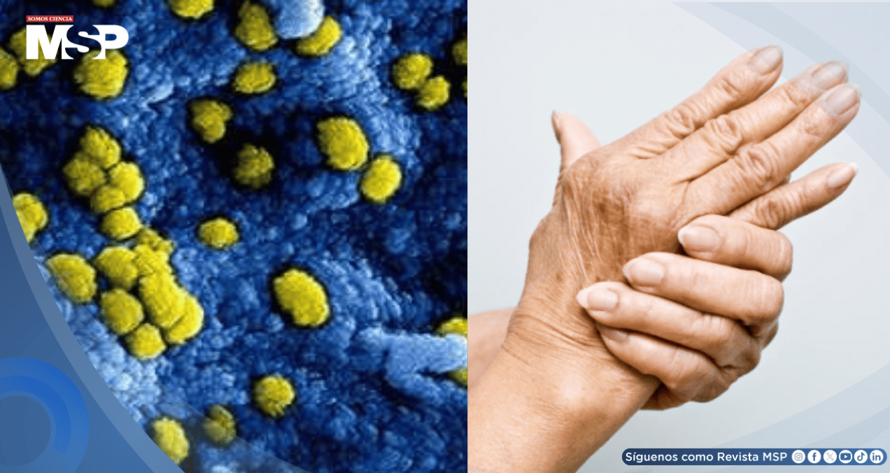 Descubren cómo el equilibrio de la microbiota podría alterar el tratamiento de enfermedades reumáticas Descubren cómo el equilibrio de la microbiota podría alterar el tratamiento de enfermedades reumáticas