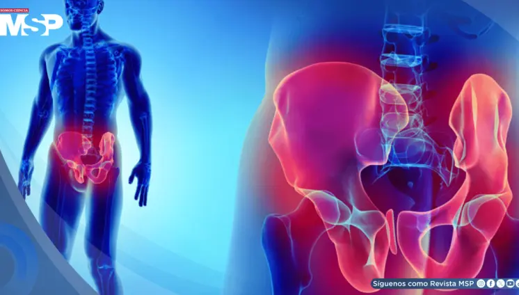 ¿Dolor en el pubis o la ingle? Podría ser pubalgia: Causas, síntomas y manejo 