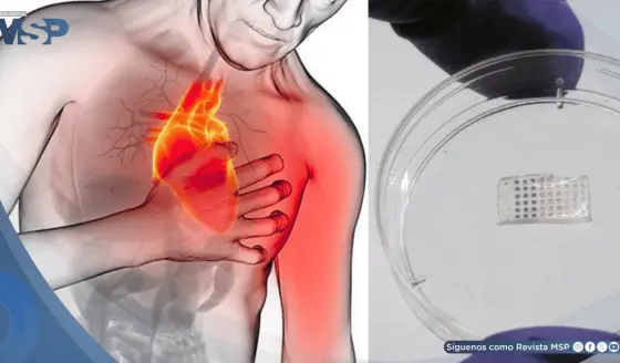 Desarrollan parche inteligente que podría regenerar el corazón tras un infarto