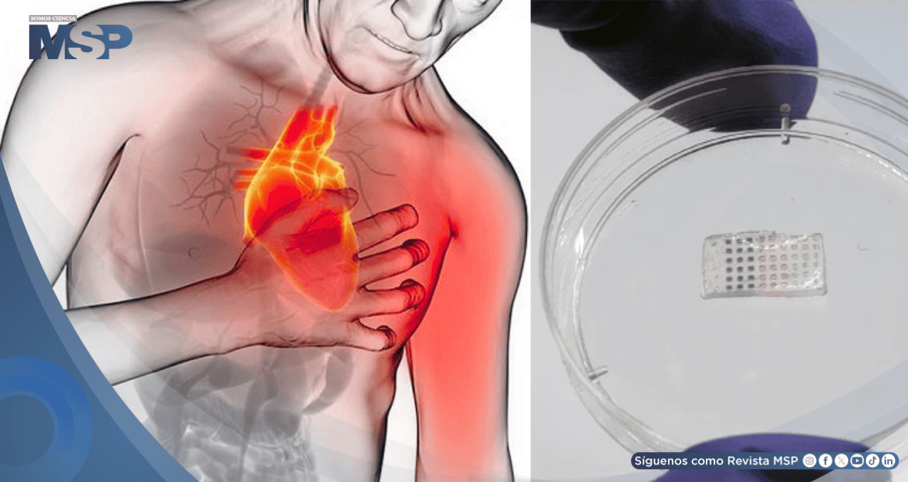 Desarrollan parche inteligente que podría regenerar el corazón tras un infarto Desarrollan parche inteligente que podría regenerar el corazón tras un infarto