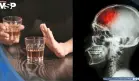Tres copas de alcohol al día aumentarían el riesgo de sufrir un derrame cerebral, según estudio