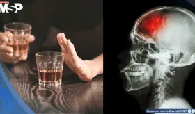 Tres copas de alcohol al día aumentarían el riesgo de sufrir un derrame cerebral, según estudio