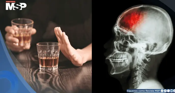 Tres copas de alcohol al día aumentarían el riesgo de sufrir un derrame cerebral, según estudio