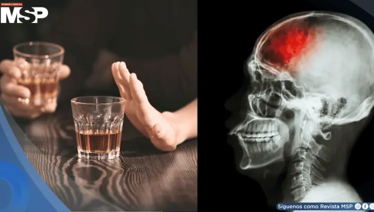 Tres copas de alcohol al día aumentarían el riesgo de sufrir un derrame cerebral, según estudio