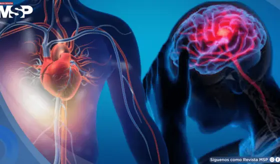 Un infarto podría duplicar el riesgo de desarrollar epilepsia en la edad adulta, según estudio