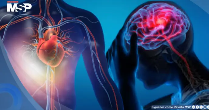 Un infarto podría duplicar el riesgo de desarrollar epilepsia en la edad adulta, según estudio