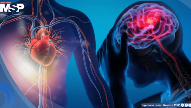 Un infarto podría duplicar el riesgo de desarrollar epilepsia en la edad adulta, según estudio