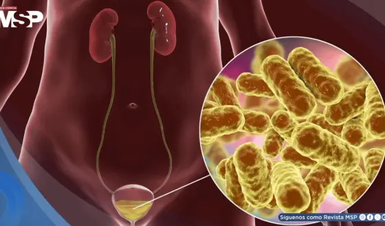 Ciclismo o usar antidepresivos: Hábitos que podrían aumentar el riesgo de infección urinaria