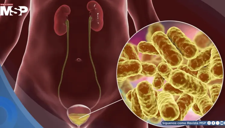 Ciclismo o usar antidepresivos: Hábitos que podrían aumentar el riesgo de infección urinaria