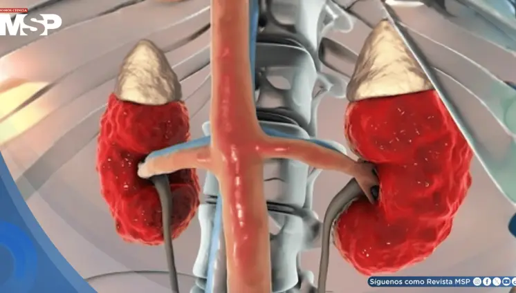 Enfermedad renal crónica afectaría a 800 millones de personas  y es vinculada con mayor riesgo cardíaco