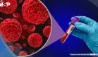 Desarrollan biopsias líquidas sanguíneas capaces de diagnosticar varios tipos de cáncer