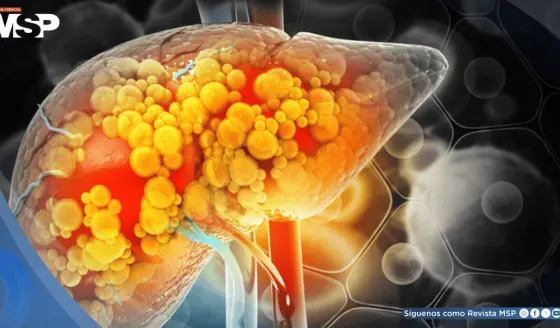 Descubren que este químico común de tintorería podría triplicar el riesgo de fibrosis hepática