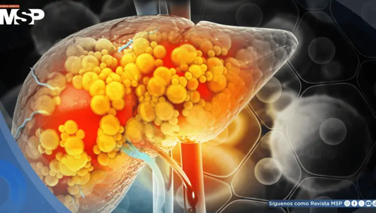 Descubren que este químico común de tintorería podría triplicar el riesgo de fibrosis hepática