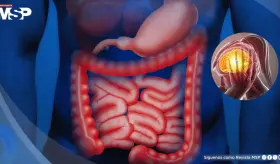 El estrés causaría inflamación en el intestino y empeoraría los problemas digestivos ya existentes