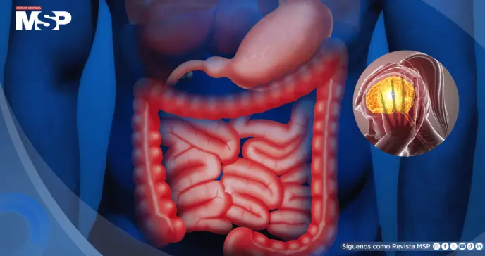 El estrés causaría inflamación en el intestino y empeoraría los problemas digestivos ya existentes El estrés causaría inflamación en el intestino y empeoraría los problemas digestivos ya existentes