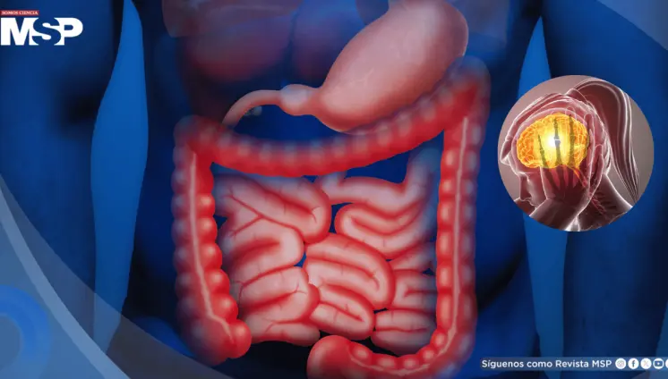 El estrés causaría inflamación en el intestino y empeoraría los problemas digestivos ya existentes
