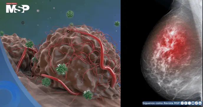 Descubren que el cáncer de mama resistiría las terapias hormonales gracias a la proteína FOXA1 Descubren que el cáncer de mama resistiría las terapias hormonales gracias a la proteína FOXA1