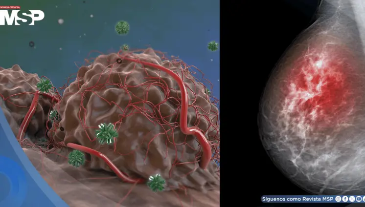 Descubren que el cáncer de mama resistiría las terapias hormonales gracias a la proteína FOXA1 Descubren que el cáncer de mama resistiría las terapias hormonales gracias a la proteína FOXA1