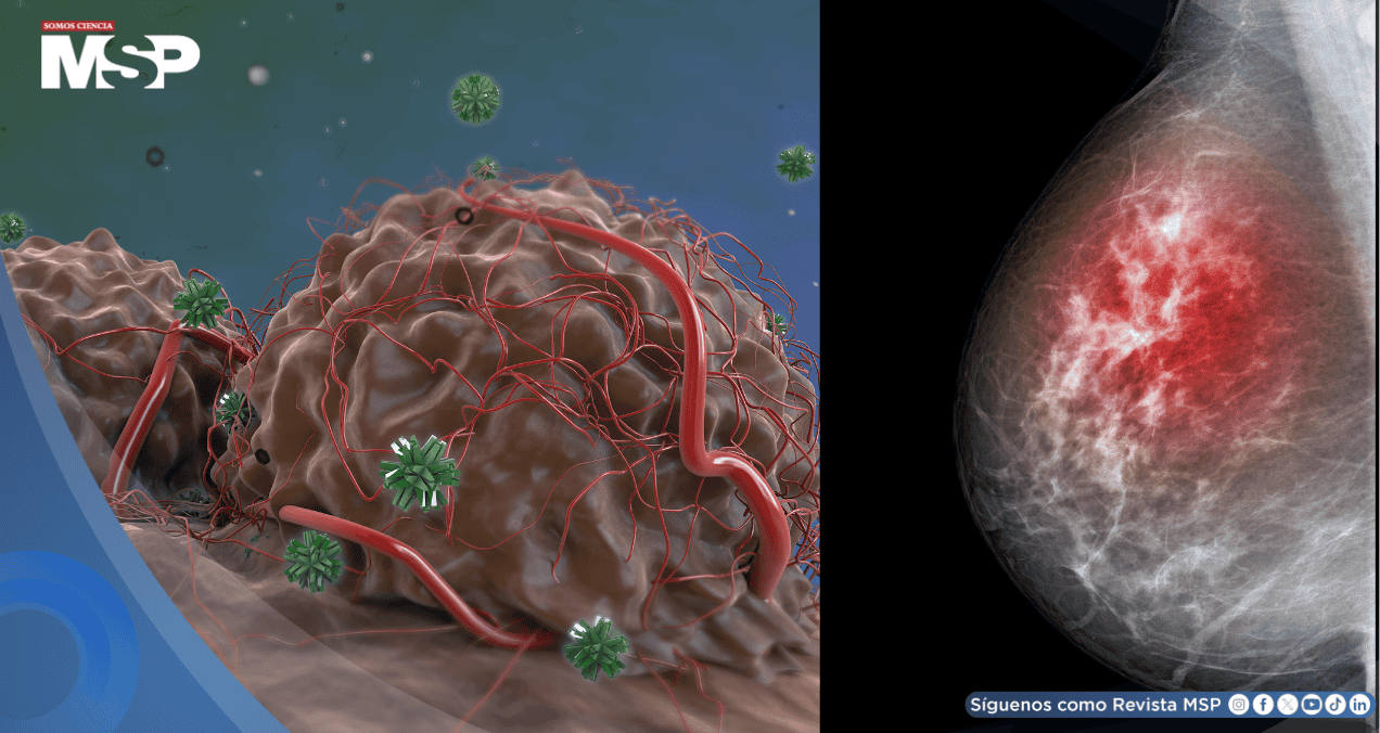Descubren que el cáncer de mama resistiría las terapias hormonales gracias a la proteína FOXA1 Descubren que el cáncer de mama resistiría las terapias hormonales gracias a la proteína FOXA1