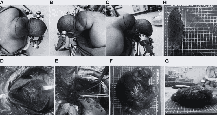 imagen-cuerpo imagen-cuerpo