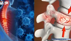 Científicos logran curar fracturas de columna con células madre de grasa corporal