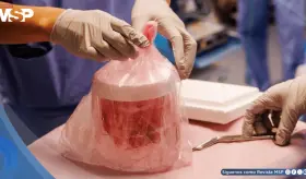 Riñón porcino mínimamente modificado opera con normalidad durante 60 días en receptor humano