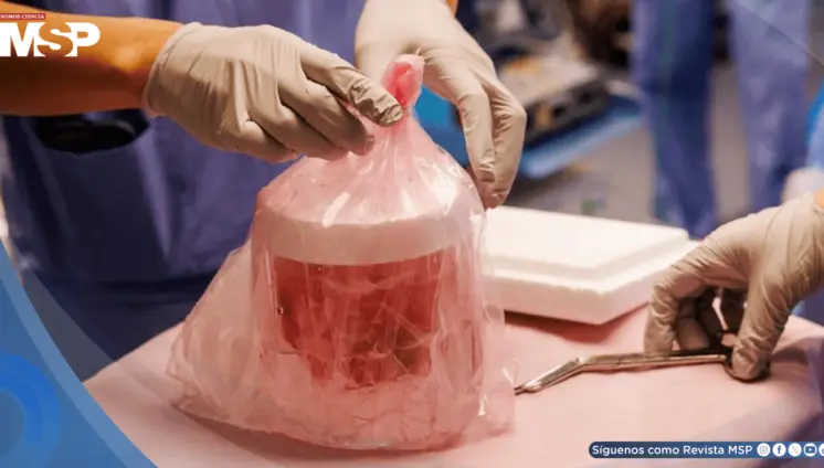 Riñón porcino mínimamente modificado opera con normalidad durante 60 días en receptor humano Riñón porcino mínimamente modificado opera con normalidad durante 60 días en receptor humano