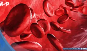 Usar vinagre de manzana para controlar la glucosa carece de evidencia y es riesgoso para diabéticos