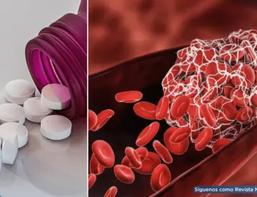 Continuar con anticoagulantes tras un trombo previene 8 de cada 10 recurrencias, revela estudio 