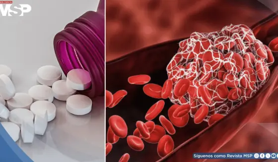 Continuar con anticoagulantes tras un trombo previene 8 de cada 10 recurrencias, revela estudio 