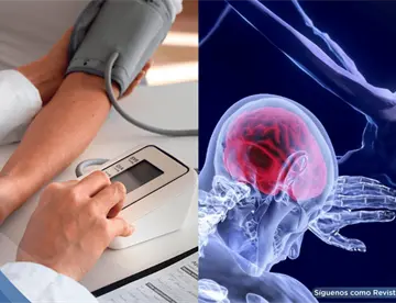 El dolor crónico podría multiplicar el riesgo de hipertensión arterial, según estudio