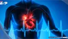 Betabloqueantes no son necesarios tras un infarto si función cardiaca es normal