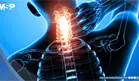 Uso del celular estaría acelerando la degeneración cervical: síntomas y manejo del cuello tecnológico