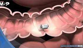 Crean píldoras inteligentes con bacterias para detectar enfermedades intestinales sin colonoscopia