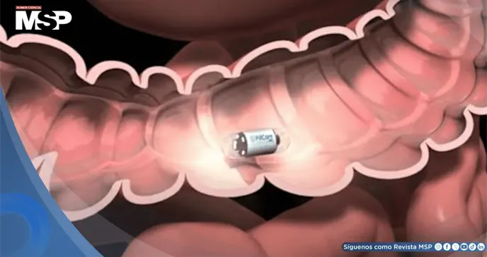 Crean píldoras inteligentes con bacterias para detectar enfermedades intestinales sin colonoscopia