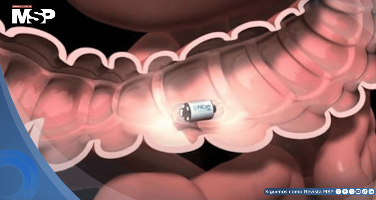 Crean píldoras inteligentes con bacterias para detectar enfermedades intestinales sin colonoscopia
