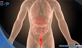 Dolor rectal, sangrado y urgencia para evacuar: síntomas que alertan sobre una proctitis 