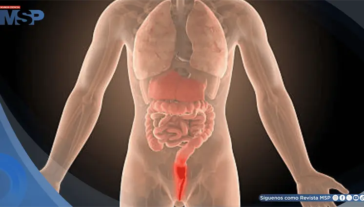 Dolor rectal, sangrado y urgencia para evacuar: síntomas que alertan sobre una proctitis Dolor rectal, sangrado y urgencia para evacuar: síntomas que alertan sobre una proctitis