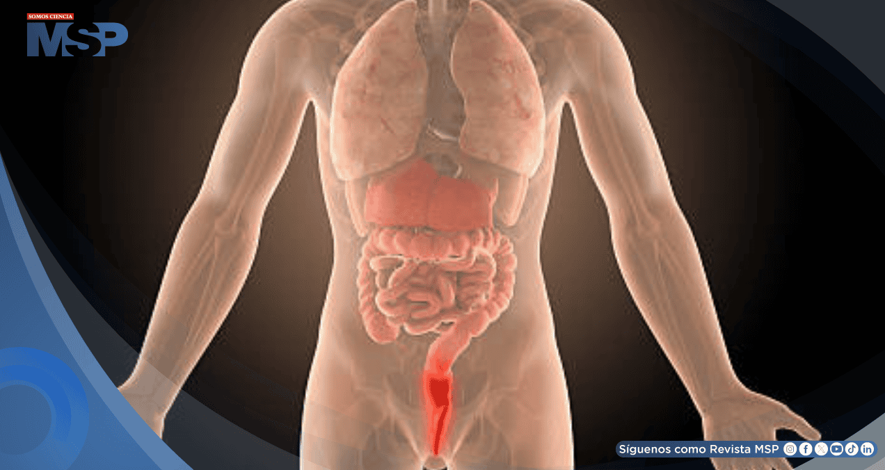 Dolor rectal, sangrado y urgencia para evacuar: síntomas que alertan sobre una proctitis 