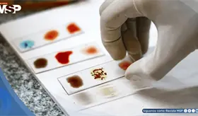 Científicos buscan cultivar en el laboratorio la sangre más rara del mundo, el valioso tipo Rh nulo