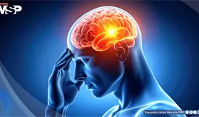 ¿Migraña, dolor de cabeza o cefalea? Así puede diferenciarlas y reconocer sus síntomas