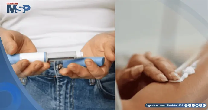 Así funcionaría la insulina en crema: Avance podría eliminar los pinchazos para pacientes diabéticos