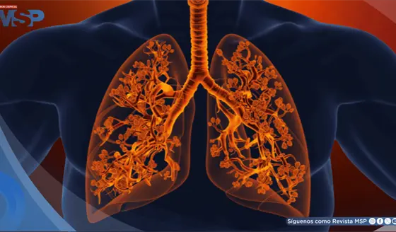Bronquiolitis obliterante o pulmón de palomitas de maíz: Síntomas, causas y tratamiento 