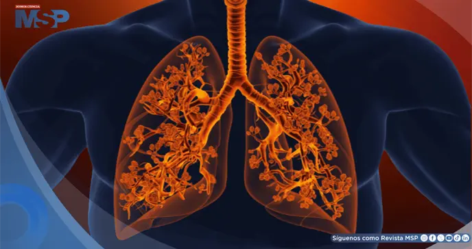 Bronquiolitis obliterante o pulmón de palomitas de maíz: Síntomas, causas y tratamiento 