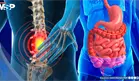 ¿Dolor de espalda constante? trastornos digestivos estarían relacionados con el dolor lumbar