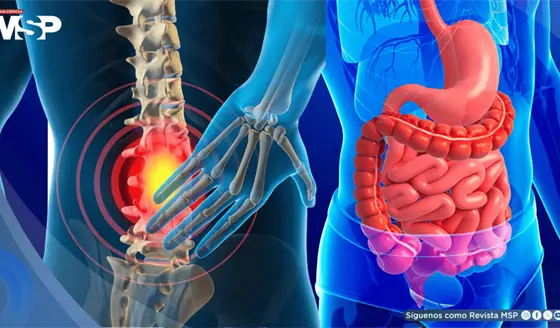 ¿Dolor de espalda constante? trastornos digestivos estarían relacionados con el dolor lumbar