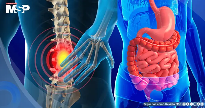¿Dolor de espalda constante? trastornos digestivos estarían relacionados con el dolor lumbar